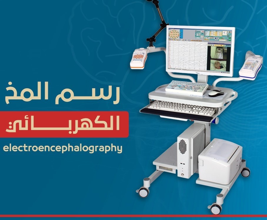 "رسم المخ الكهربائي (EEG) يوضح النشاط الكهربائي للدماغ لتشخيص التشنجات عند الأطفال"